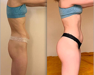 Transformations (14)