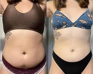 Before and after transformation of a Bite Back with Liz coaching client