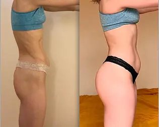 Before and after transformation of a Bite Back with Liz coaching client